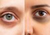 घर पर डार्क सर्किल हटाने के टिप्स हिंदी में । Dark circle remover home tips in Hindi Dark circle remover home tips in Hindi
