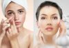 पिंपल फ्री फेस पाने की टिप्स हिंदी में । Pimple free face tips in Hindi Pimple free face tips in Hindi