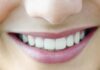 दांतो की देखभाल के लिए टिप्स हिंदी में । Teeth care tips in Hindi Teeth care tips in Hindi